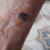Batu Anti Rabies ada di Manggarai Timur