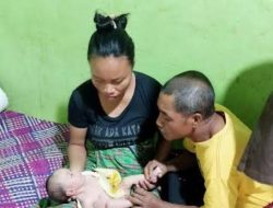 Nasib Pilu Bayi Asal Desa Compang Cibal Lahir Tanpa Anus