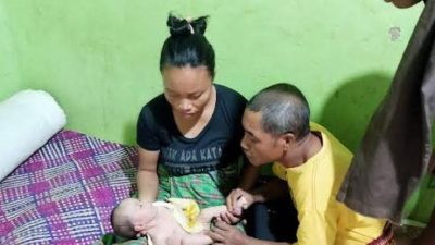 Nasib Pilu Bayi Asal Desa Compang Cibal Lahir Tanpa Anus