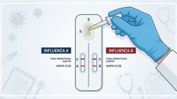 Influenza Tipe A: Gejala, Beda dengan B, dan H5N1