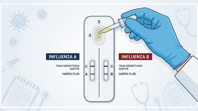Influenza Tipe A: Gejala, Beda dengan B, dan H5N1